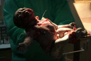 寶貝女兒出生紀錄(有血！不喜勿點入)