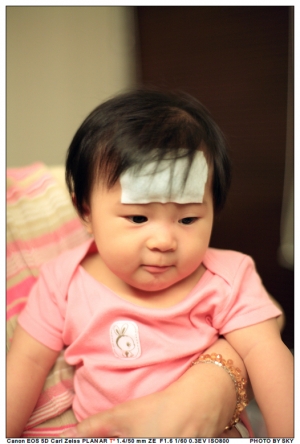 ABBY之發燒燒