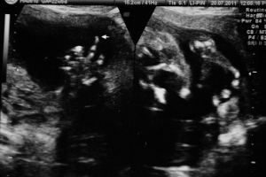 家裡的小便當&nbsp;&nbsp;1～3M （圖多）