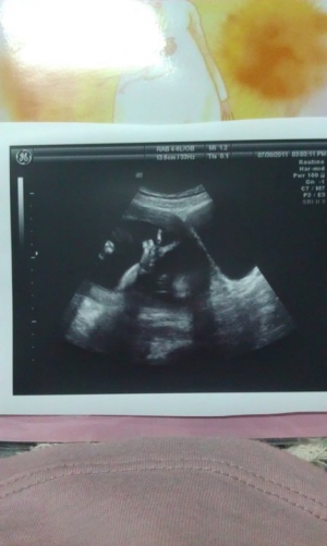 寶寶4個多月，超音波就會搶鏡頭..